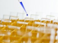 Za Imunološki zavod stiglo osam pisama namjere